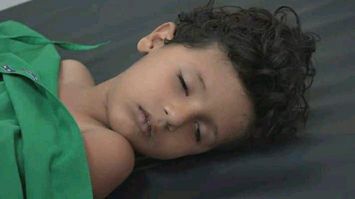 استشهاد 5 اطفال جنوب الحديدة بعبوة ناسفة زرعها الحوثي