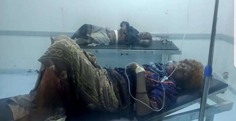 اصابة دحباش وزروجته بقذيفة حوثية في حيس غرب اليمن