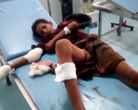 اصابة طفل بقصف حوثي على منطقة "المتينة" في الساحل الغربي