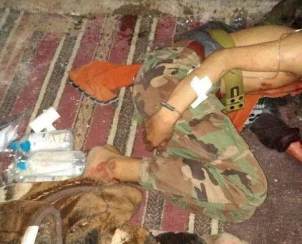 القبض على ثلاثة قيادات حوثية في جبهة المحازمية البيضاء وسط اليمن