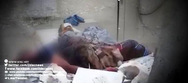 الحديدة .. قتلى  وجرحى الحوثيون في حيس والدريهمي تملاء المستشفيات