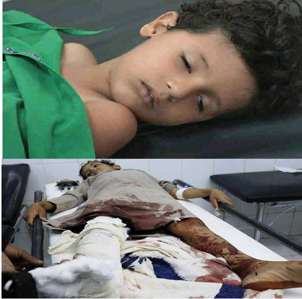 الحوثي يقتل الاطفال في اليمن (ارشيفية )