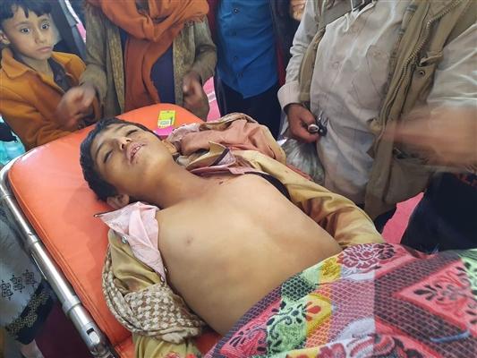 استشهاد طفلا برصاص قناص حوثي في الضالع