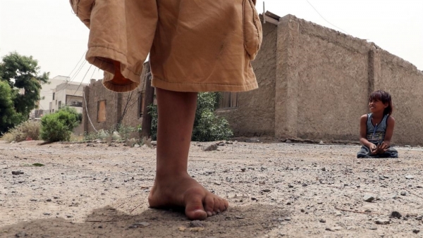 منظمة دولية تكشف حصيلة صادمة من ضحايا الحرب في اليمن 