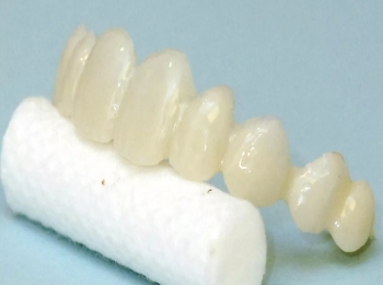 صفوف أسنان صناعية 